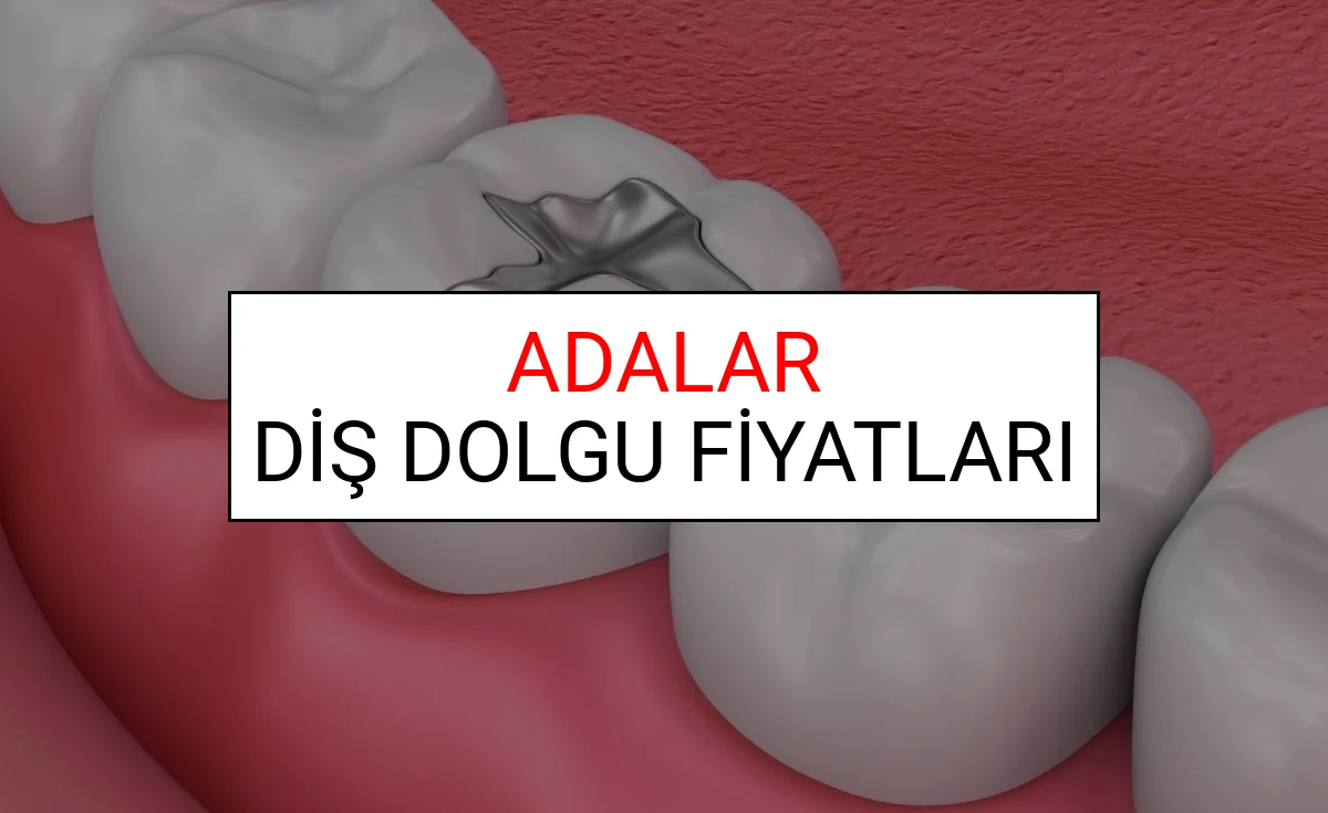 Adalar Diş Dolgu Fiyatları