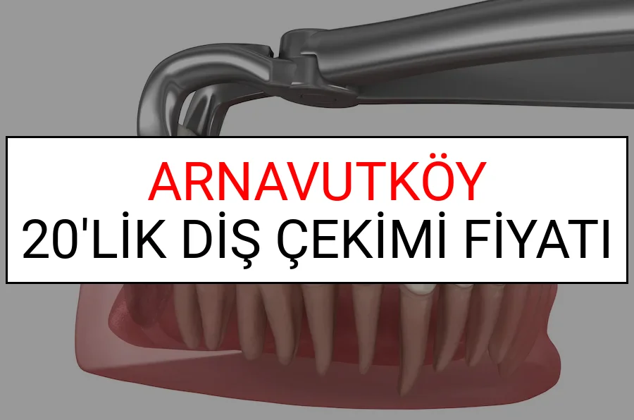 Arnavutköy 20’lik Diş Çekimi Fiyatları
