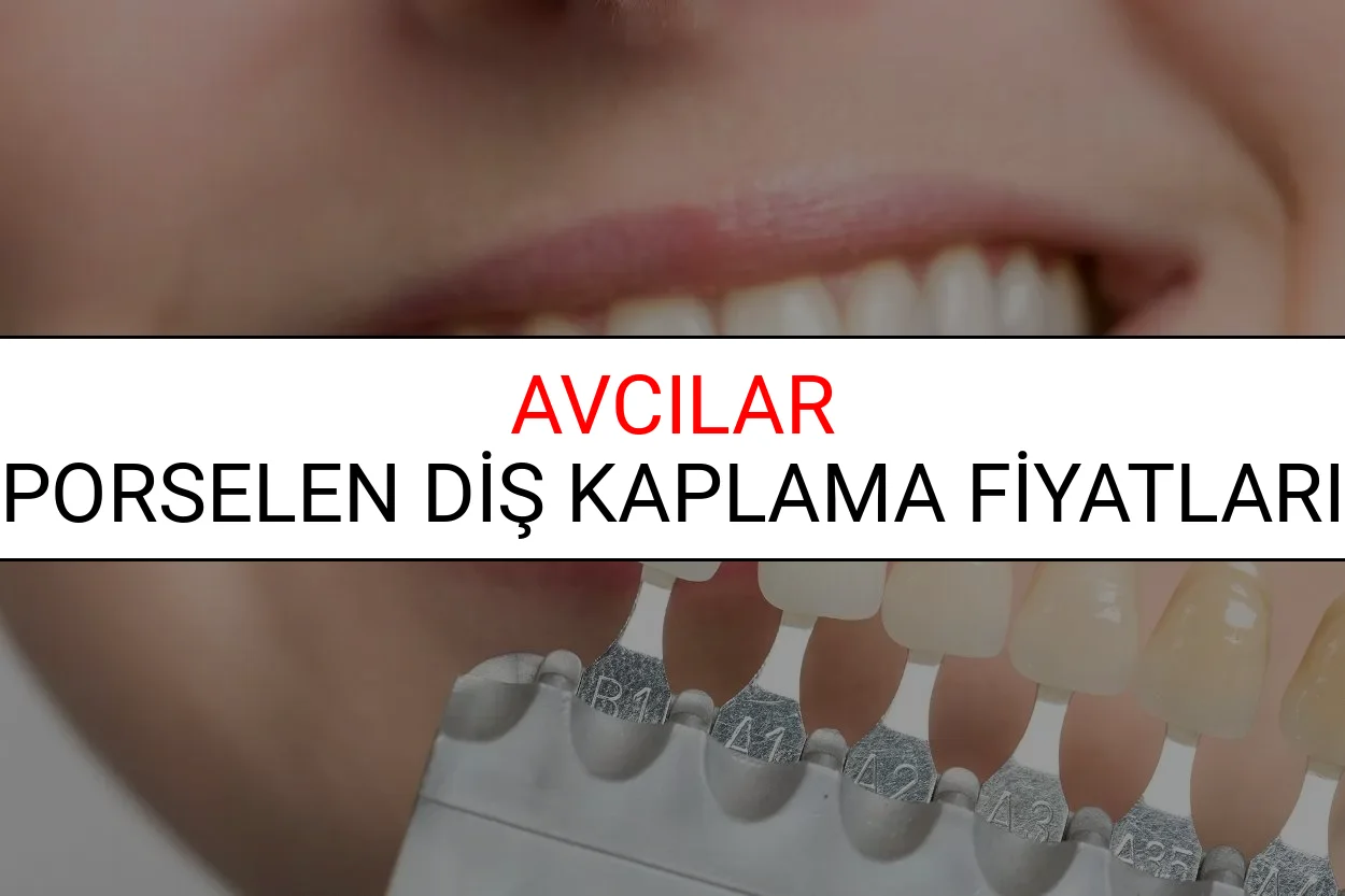 Avcılar Porselen Diş Kaplama Fiyatları