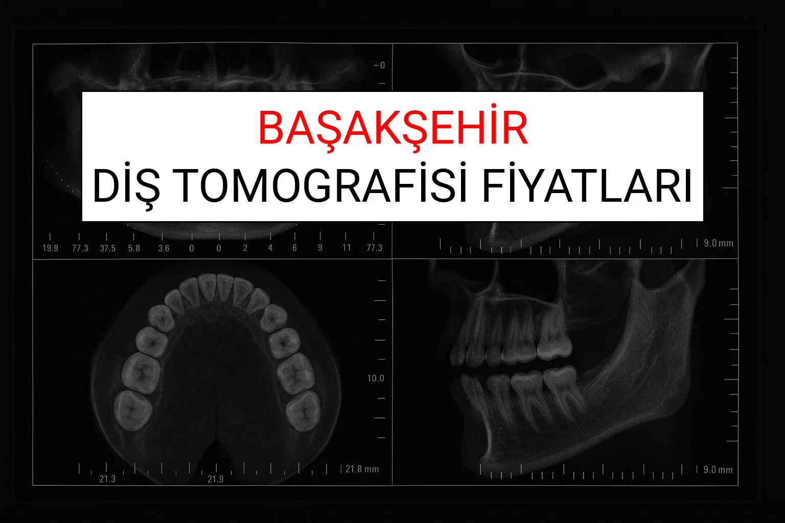 Başakşehir Diş Tomografisi Fiyatları