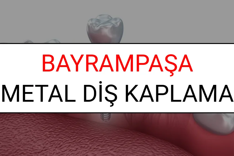 Bayrampaşa Metal Diş Kaplama Fiyatları