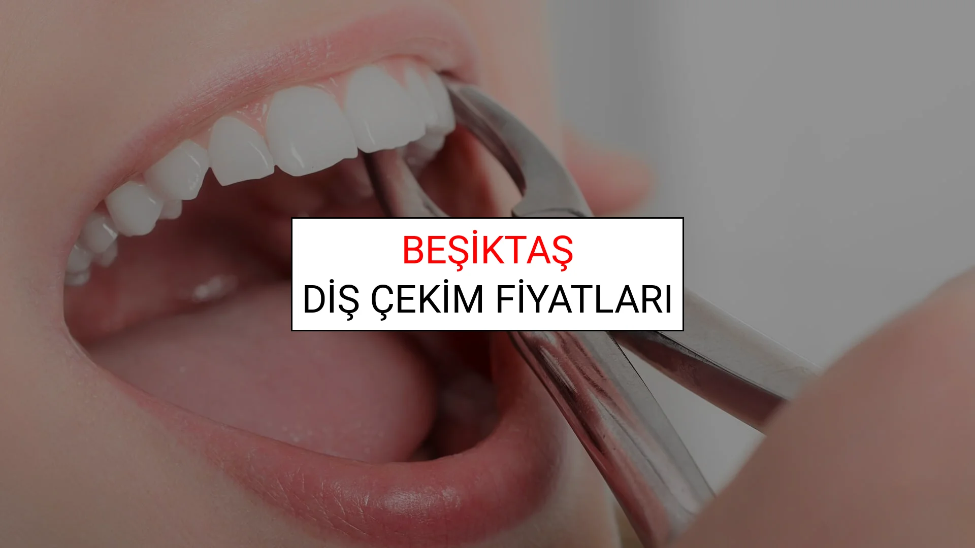 Beşiktaş Diş Çekim Fiyatları
