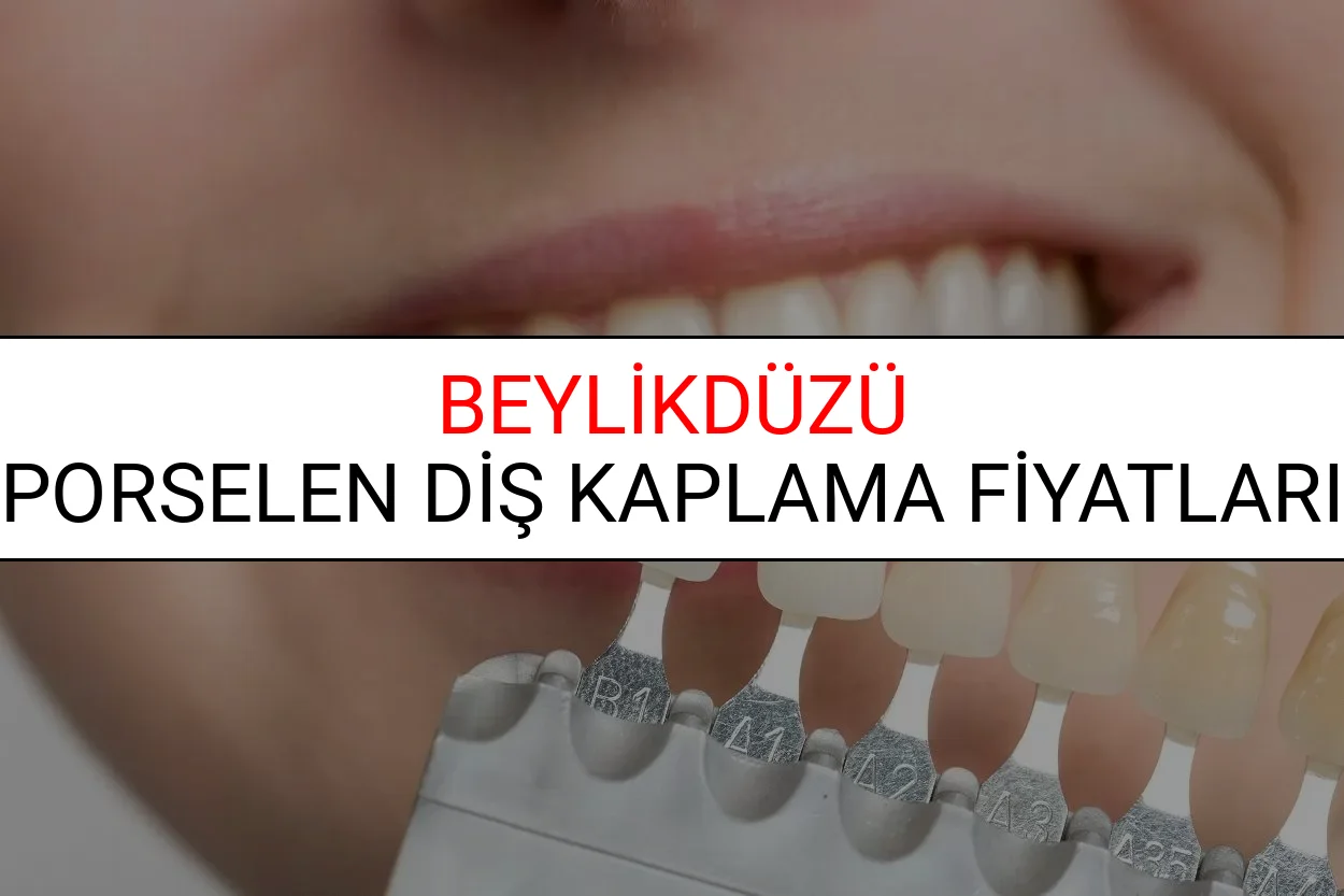 Beylikdüzü Porselen Diş Kaplama Fiyatları
