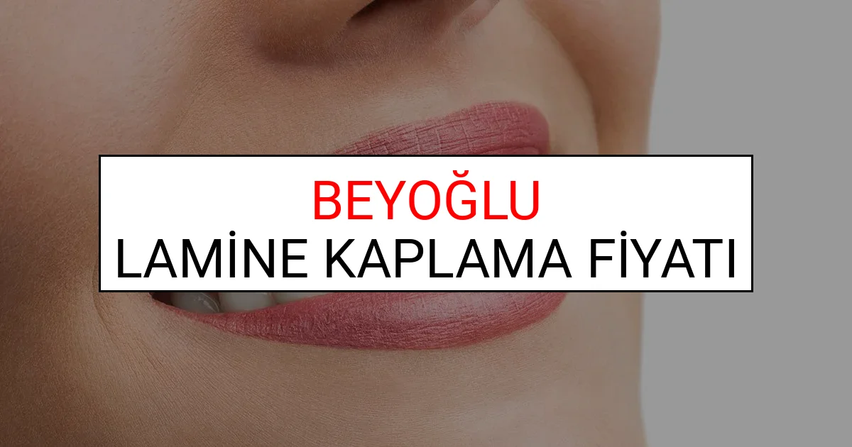 Beyoğlu Lamine Diş Kaplama Fiyatları