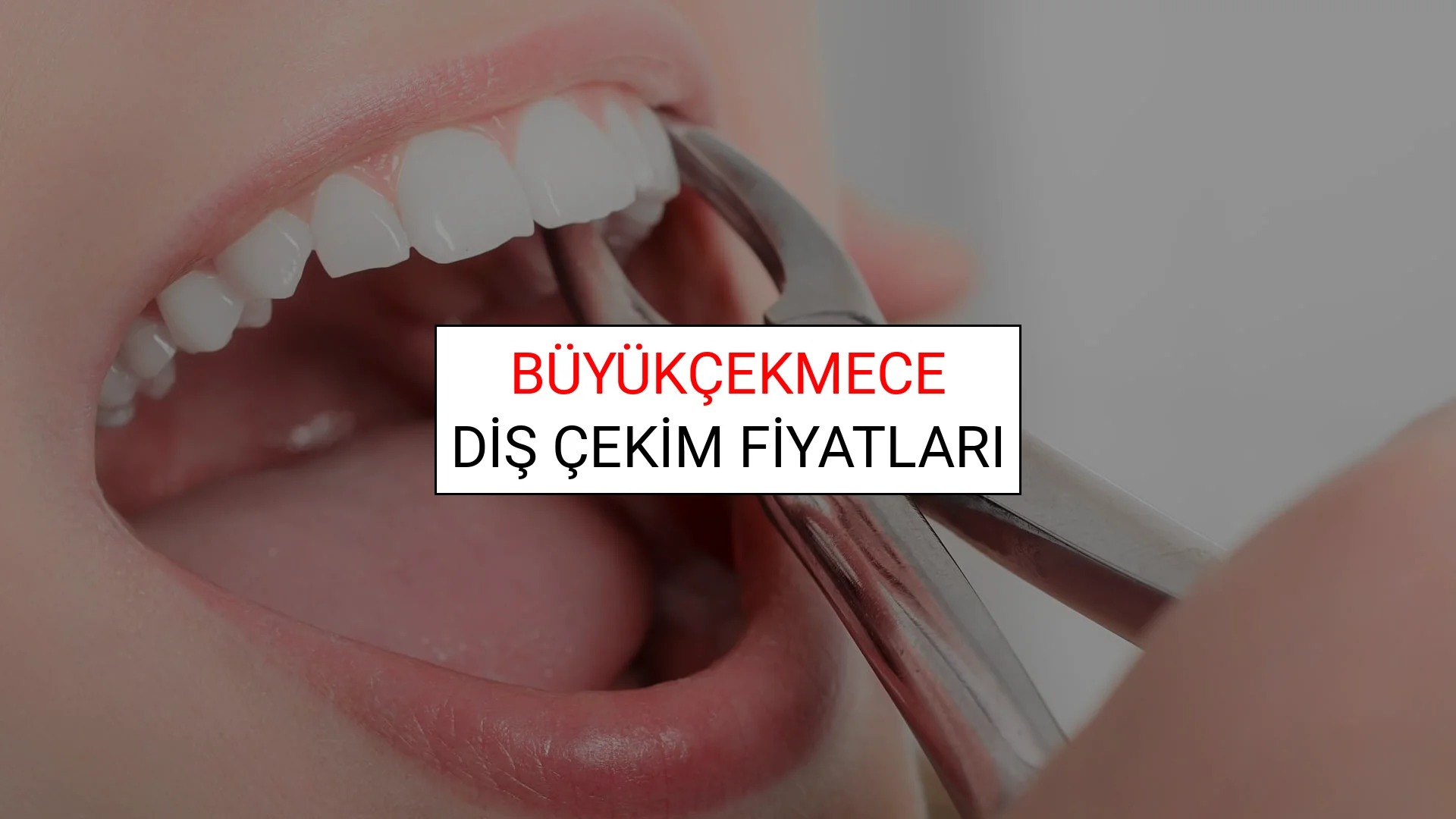 Büyükçekmece Diş Çekim Fiyatları
