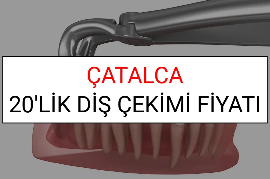 Çatalca 20’lik Diş Çekimi Fiyatları