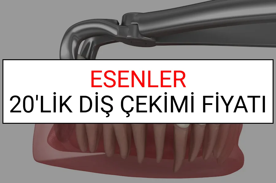 Esenler 20’lik Diş Çekimi Fiyatları