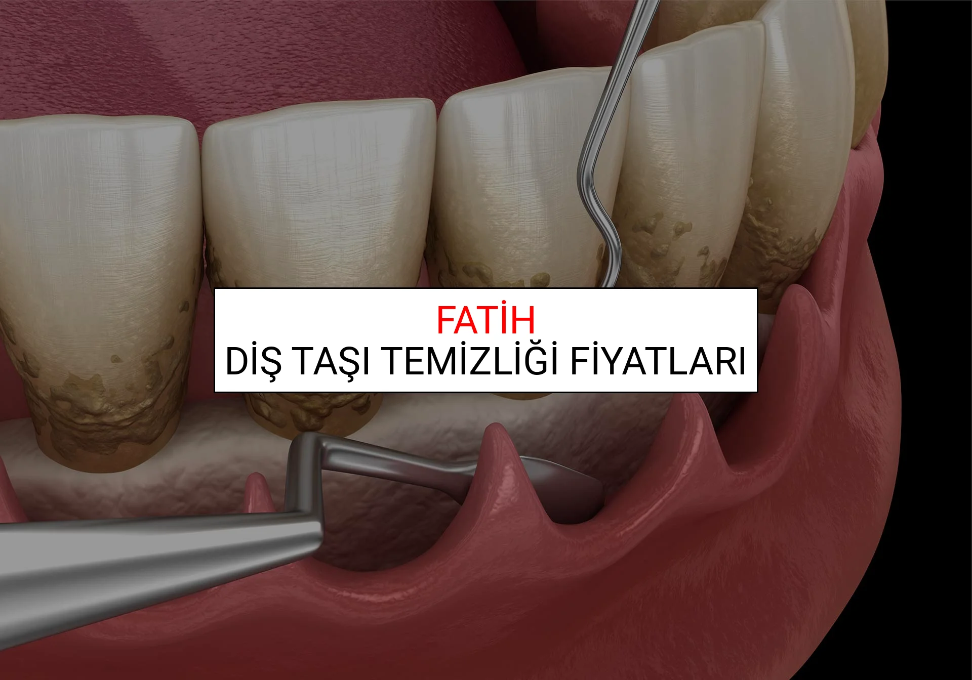 Fatih Diş Taşı Temizliği Fiyatları