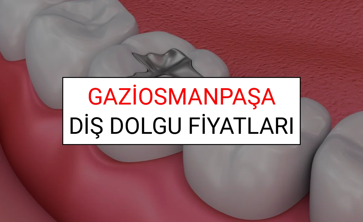 Gaziosmanpaşa Diş Dolgu Fiyatları