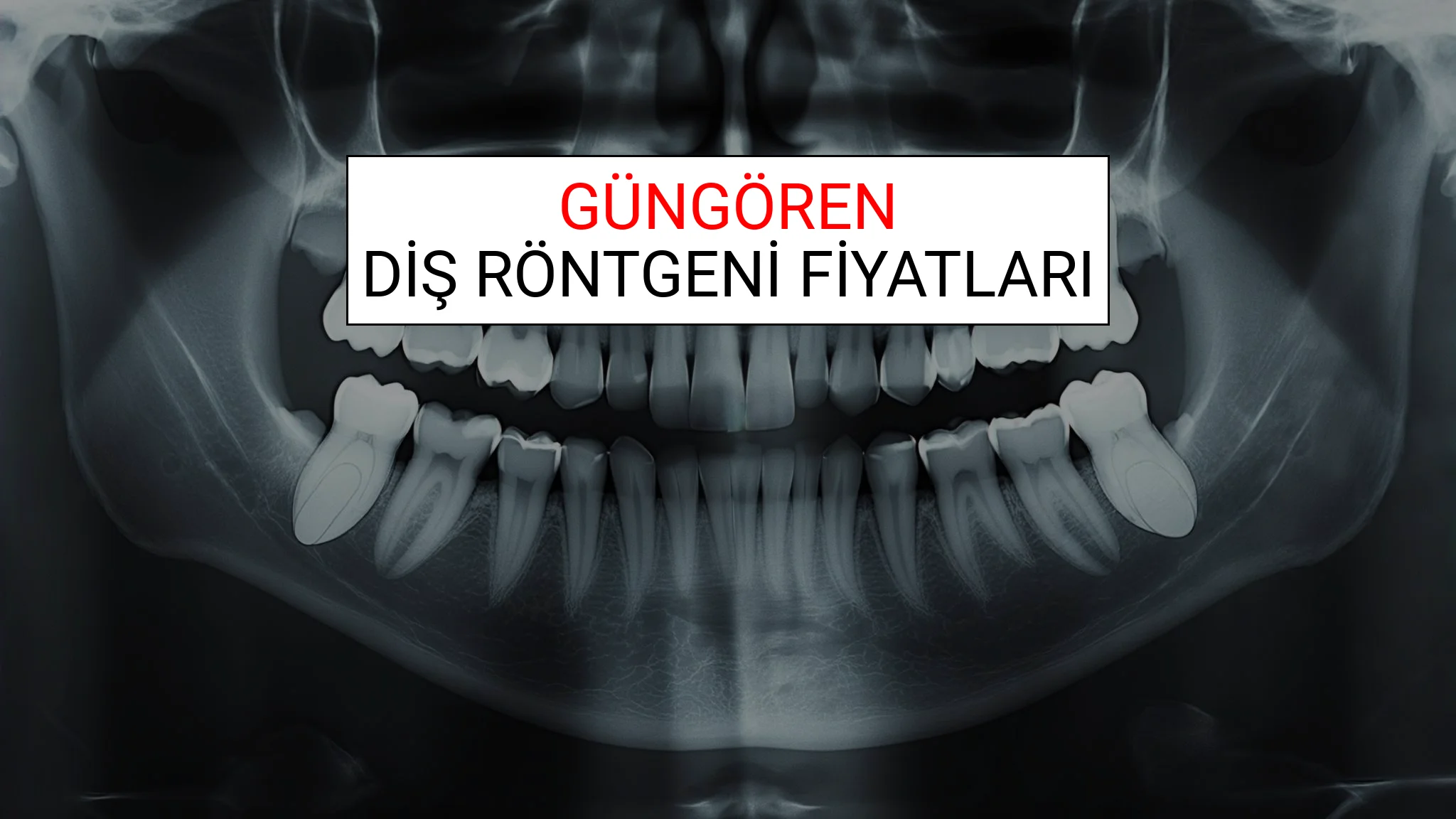 Güngören Diş Röntgeni (Periapikal) Fiyatları