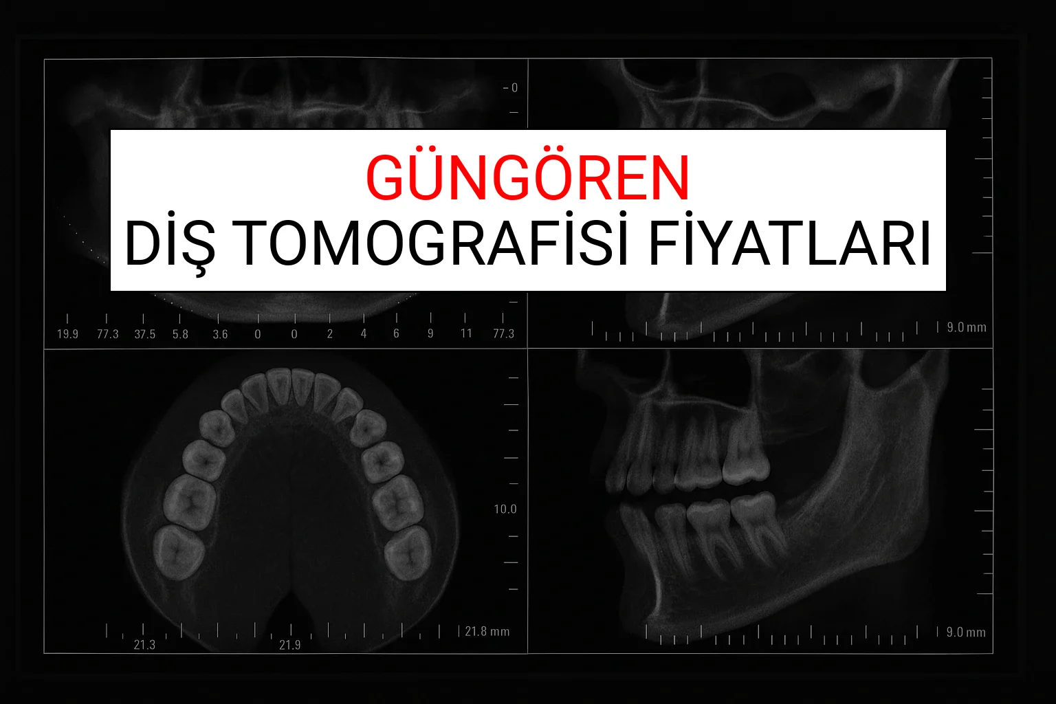Güngören Diş Tomografisi Fiyatları