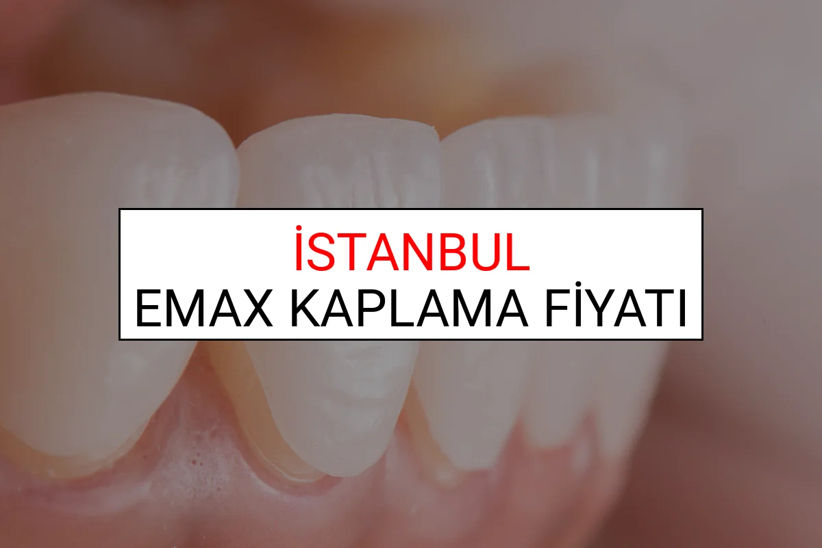 İstanbul Emax Diş Kaplama Fiyatları
