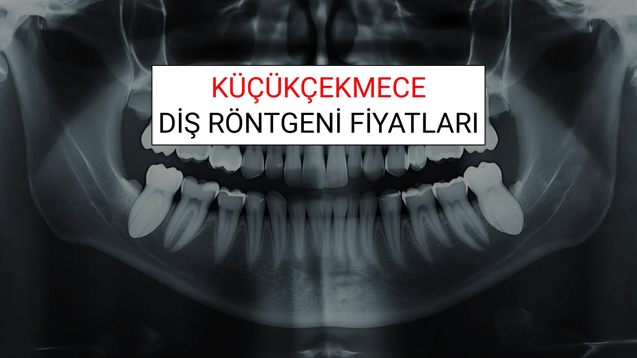 Küçükçekmece Diş Röntgeni (Periapikal) Fiyatları