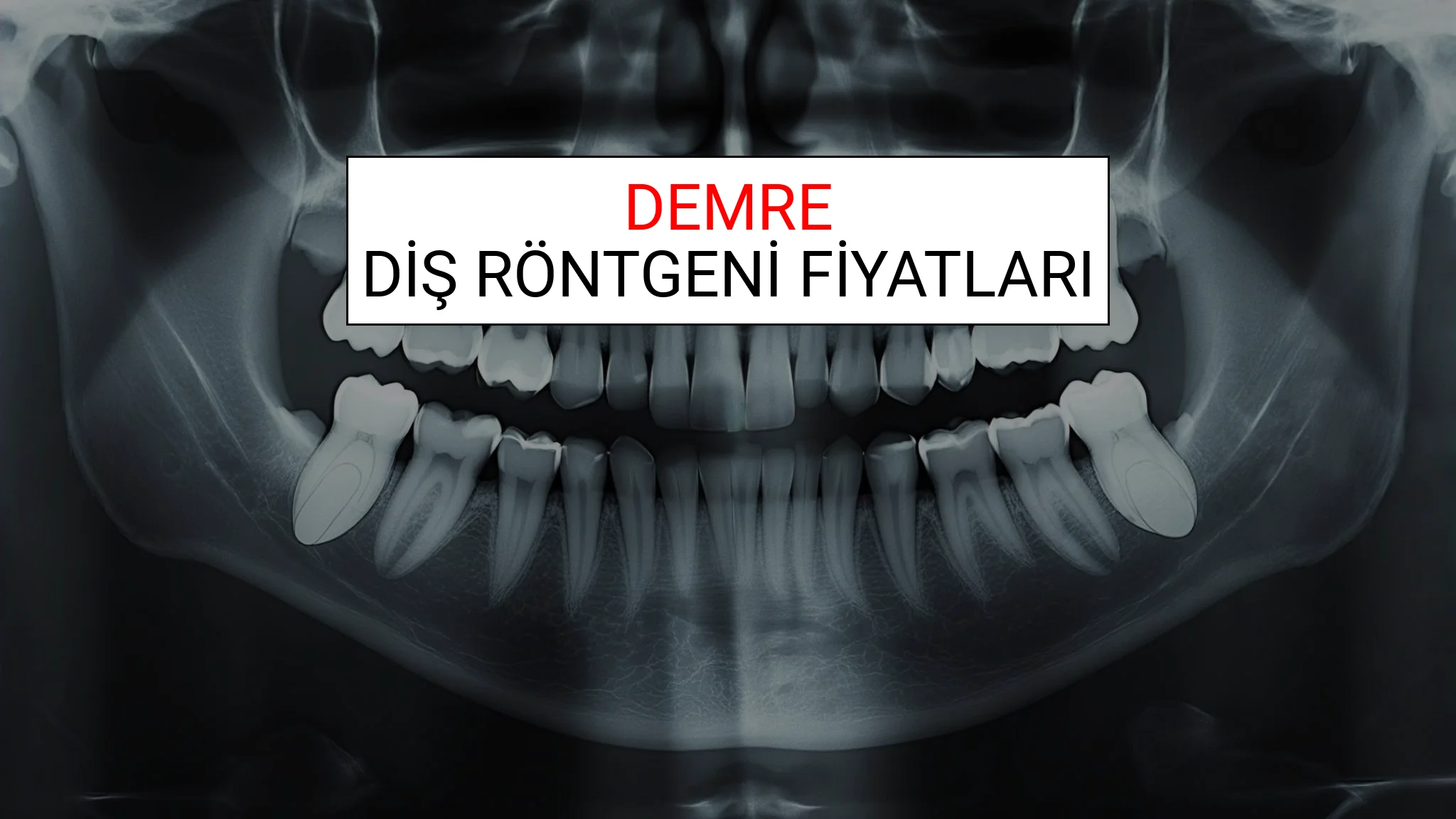Nobel Biocare İmplant Fiyatları