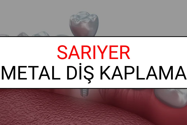 Sarıyer Metal Diş Kaplama Fiyatları