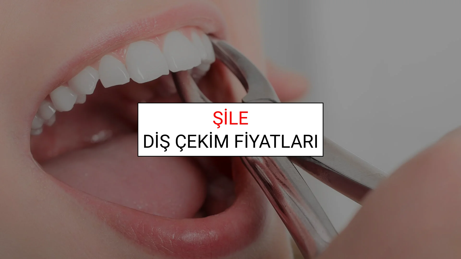 Şile Diş Çekim Fiyatları