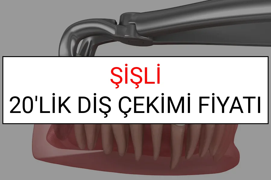 Şişli 20’lik Diş Çekimi Fiyatları