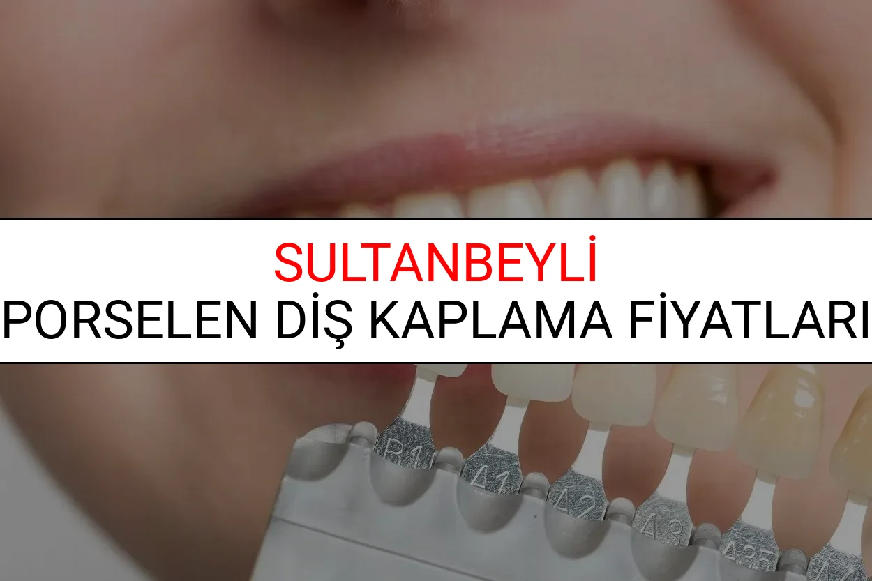 Sultanbeyli Porselen Diş Kaplama Fiyatları