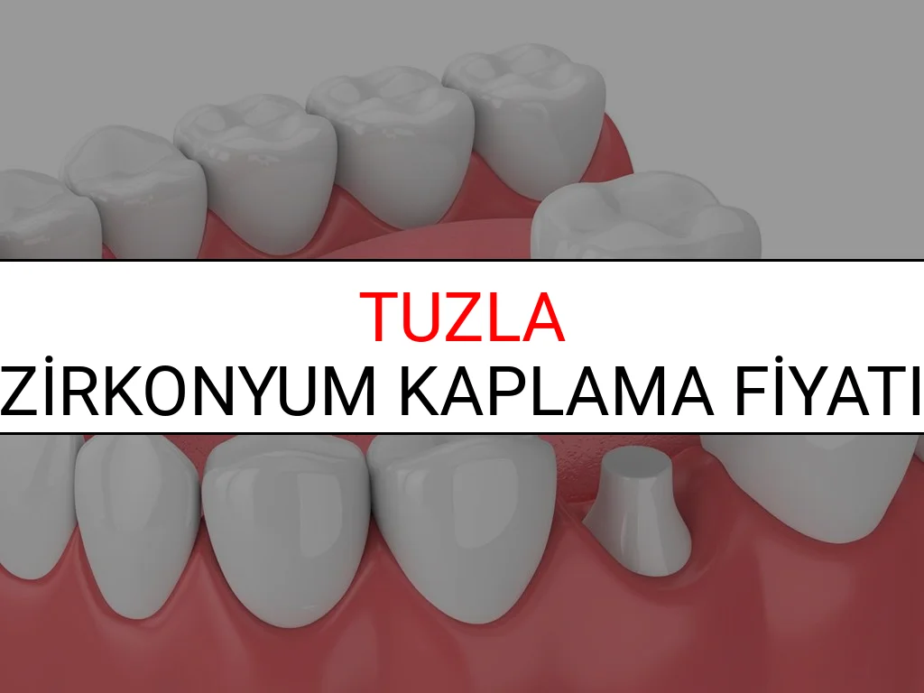 Tuzla Zirkonyum Diş Kaplama Fiyatları