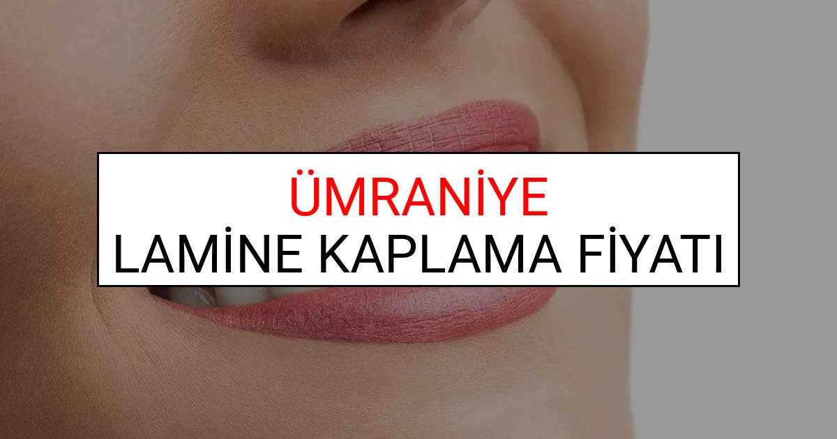 Ümraniye Lamine Diş Kaplama Fiyatları