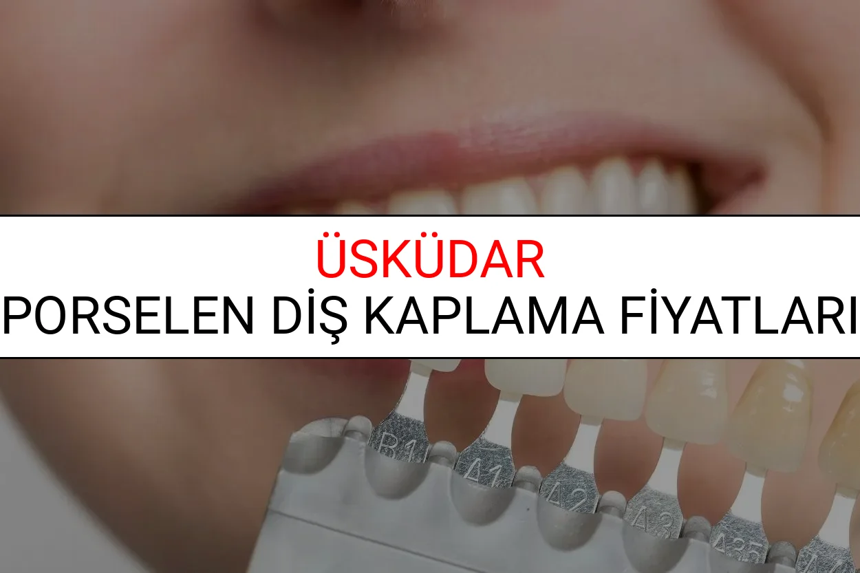 Üsküdar Porselen Diş Kaplama Fiyatları