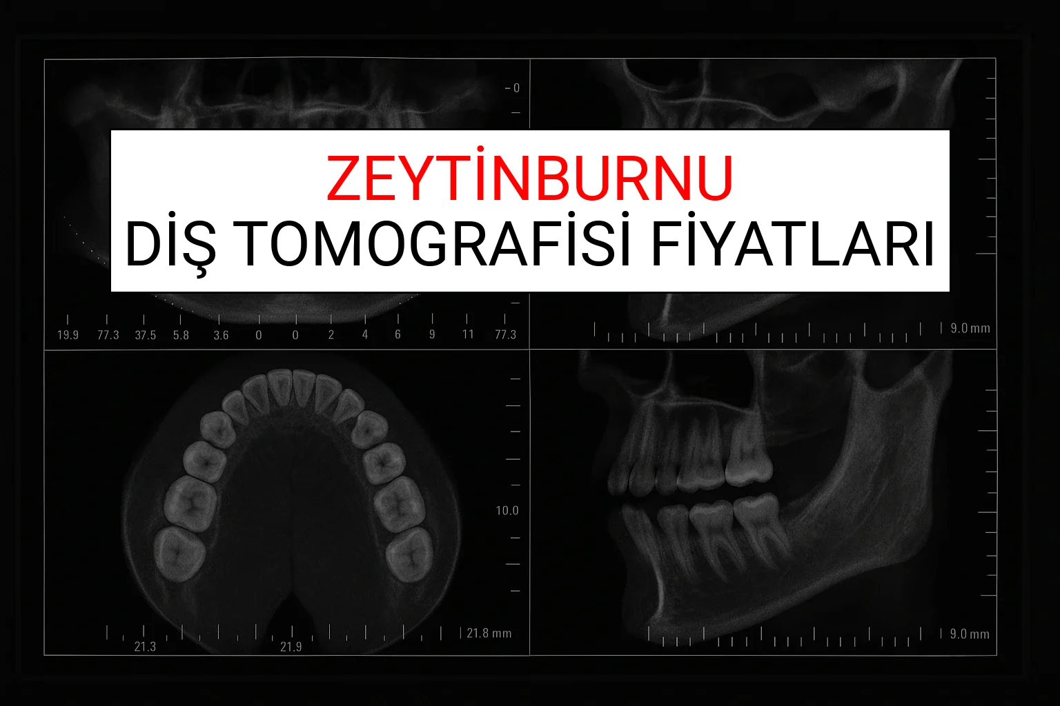 Zeytinburnu Diş Tomografisi Fiyatları